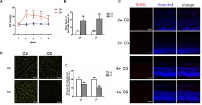 The Dynamic Scleral Extracellular Matrix Alterations in Chronic Ocular Hypertension Model of Rats